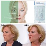 Collagen Threads Manufacturer - OEM No Needle Radar Silk Protein Line