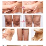 Armpit Whitening Cream Manufacturer - 2023 Latest Vegan Herbal Nicotinamide