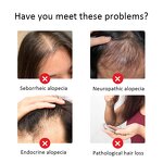 Essential Oil Manufacturer - Wholesale Private Label Organic Rosemary Hair Growth