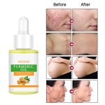 Turmeric Essential Oil Manufacturer - Private Label Aromatherapy Massage