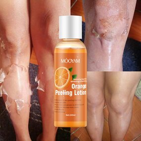 Peeling Lotion Manufacturer - Skin Lightening Whitening Exfoliating