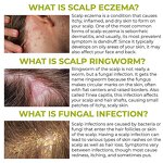 Tea Tree Shampoo Factory - Organic Hair Growth Anti-Loss