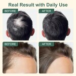 Hair Growth Serum Manufacturer - 5% Biotin Herbal Extracts