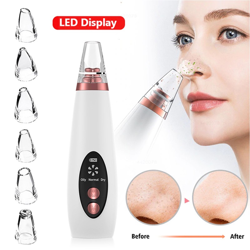 Blackhead Remover Vacuum Factory - OEM 3 Color Light Skin Care Acne Pimples Treatment Hot