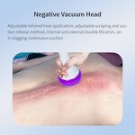 Portable Cryolipolysis Machine Factory - Fat Freezing for Body Legs Arms Double Chin