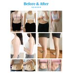 Cryo Body Slimming Machine Factory - Top 1 Shaping Fast Freezing Cooling Plate Skin Firming