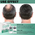 Cold Plasma Machine Manufacturer - Newest 8 in 1 Hyper Fibroblast Plasma Jet Removal