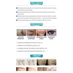 Carbon Facial Skin Rejuvenation Machine Factory - Hollywood Peel Multifunction Pigment Removal