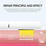 Professional Vaginal Tightening Machine Factory - ZS Intensive Rejuvenation Firming Skin