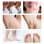 Beauty Laser Machine Factory - G 2025 Hot Sale Professional 808nm 755nm 1064nm