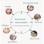 Carbon Peel Laser Machine Manufacturer - Hot Y Q Switched ND YAG Tattoo Removal