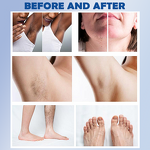 Diode Laser Hair Removal Machine Manufacturer - 808nm 2400W Ice Platinum Beauty Equipment