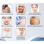 Skin Resurfacing Machine Manufacturer - OEM/ODM GZ Factory Direct Selling CO2 for Acne