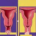 RF Microneedle Machine Manufacturer - G Handheld Fractional Gold Skin Rejuvenation Face Lift