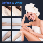 Diode Laser Hair Removal Machine Factory - Blue White 2 in 1 755 808 1064nm