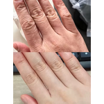 3d Skin Analyzer Machine Manufacturer - 2025 a New Arrival Facial Scalp Scanner Analysis