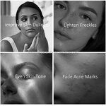 Skin Whitening Products Manufacturer - Pure Nicotinamide Riboside