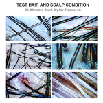 Skin Analyzer Factory - 7 Inch Scalp Detector Rechargeable