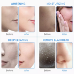 Aqua Peeling Solution Factory - 30ml Strong Cleansing Skin