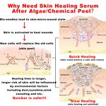 Freeze Dried Mask Factory - Healing Peptide Sheet Post Treatment