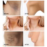 Neck Roller Cream Manufacturer - Wholesale 120g Deep