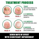 Black Spot Cream Factory - Improves Darkness Diminishes