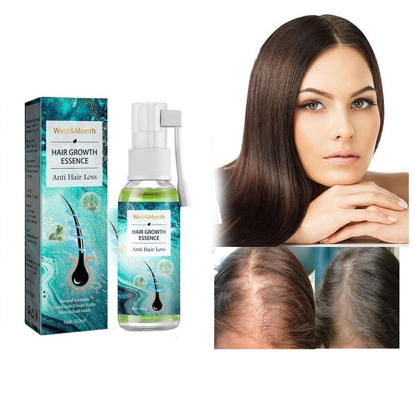 Hair Growth Lotion Manufacturer - Herbal Ginseng Ginger