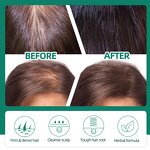 Hair Growth Lotion Manufacturer - Herbal Ginseng Ginger