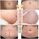 Scar Removal Cream Factory - 50ml Caesarean Section Care