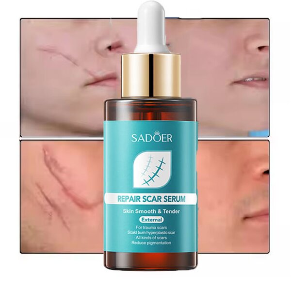 Pregnancy Scar Cream Factory - Women's Lighten Body Skin