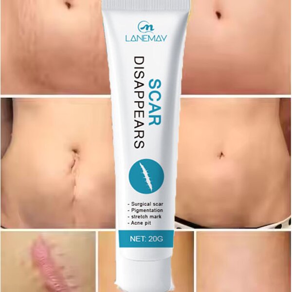 Scar Repair Cream Manufacturer - Best-selling Rapid Healing