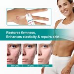 Pregnancy Marks Cream Factory - Best-selling Mild Treatment