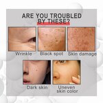 Niacinamide Cleanser Factory - Boshi Spring Oil Control