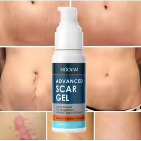 Scar Serum Factory - Facial Body Moisturizing Repair