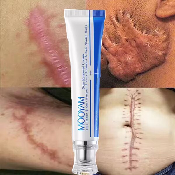 Scar-removing Cream Manufacturer - Lavender Herbal Powerful