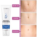 Whitening Cream Manufacturer - Private Moisturizing