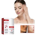 Sulfur Soap Factory - Mite Removal Liquid Fragrance