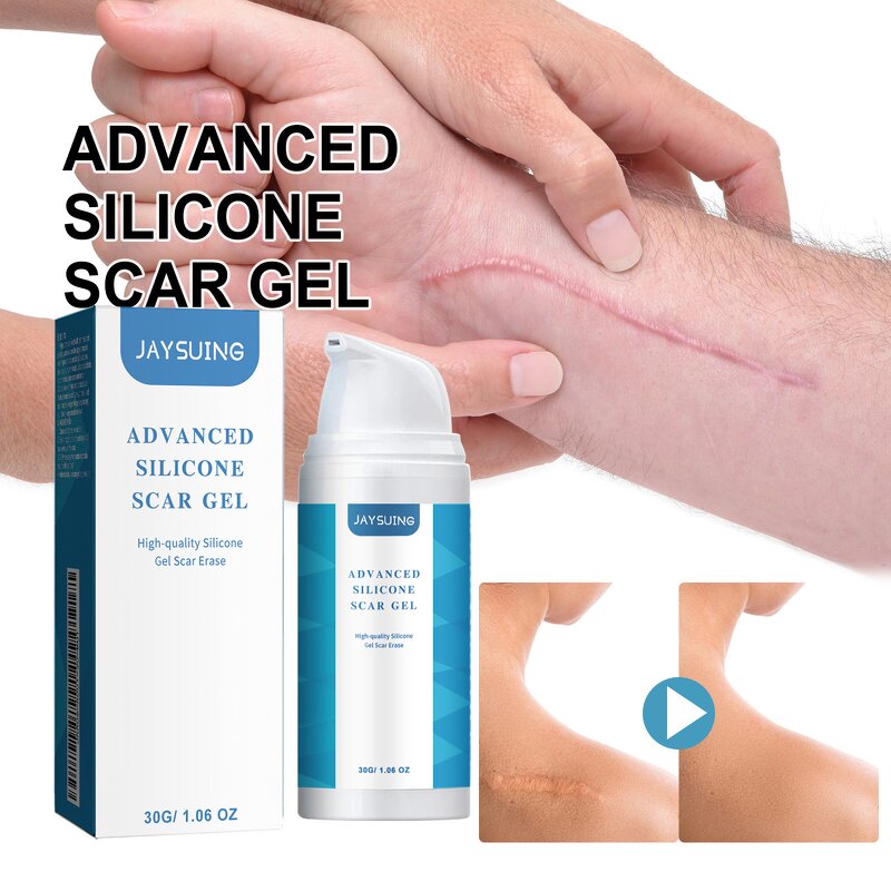 Scar Removal Cream Manufacturer - Wholesale Best-selling Quick