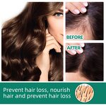 Hair Growth Lotion Manufacturer - Herbal Ginseng Ginger