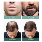 Hair Cream Manufacturer - Herbal Growth Prevention