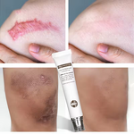 Body Repair Cream Manufacturer - Wholesale Herbal Cold