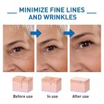 Moisturizing Spray Manufacturer - Vitamin C Lighten Acne