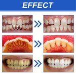 Teeth Whitening Mouthwash Factory - Fresh Breath OEM