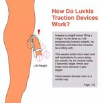 Penis Stretcher Supplier - Enhancement Kit Bulk