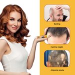 Hair Growth Cream Supplier - Scalp Care Custom Formula