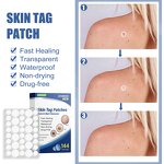 Wart Removal Stick Factory - Gram Wart Care OEM