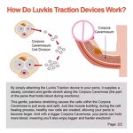 Penis Stretcher Supplier - Enhancement Kit Bulk