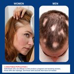 Hair Growth Cream Supplier - Scalp Care Custom Formula