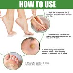 Corn Removal Plaster Factory - Wart Care OEM/ODM