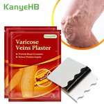 Varicose Veins Patch Supplier - Herbal Plasters Bulk